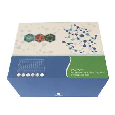 Human Hepatitis B Virus Surface Antigen / HBsAg ELISA Kit